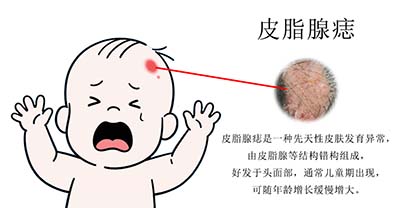 <strong>皮肤讲堂：宝宝皮脂腺痣不长头发正常吗？能植发吗？</strong>